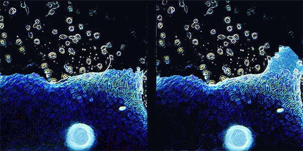 Novel ‘Scaffolding’ Biomaterial Improves Bladder Regeneration and Function 