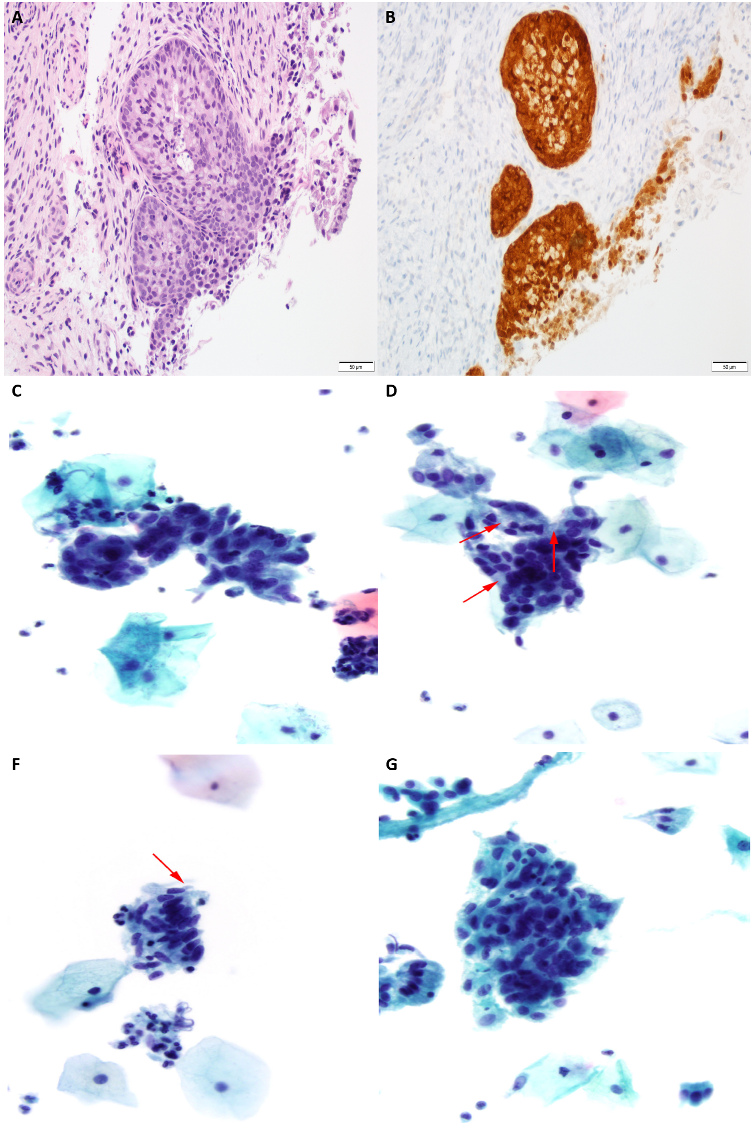 apical area cytology