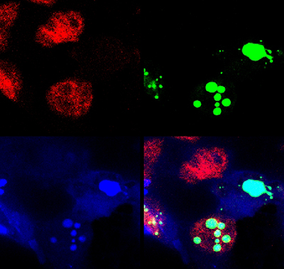 colorful, processed image showing neurological research