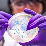 a scientist holds a petri dish